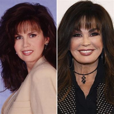 Did Marie Osmond Have Plastic Surgery? Exploring the Rumors and Realities